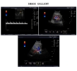 TH-1000 Color Doppler B Ultrasound scanner