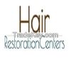 Affordable Hair Transplants Los Angeles