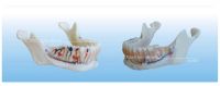 Акриловый Denture - зубоврачебная модель изучения