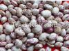 Crop 2014 KIDNEY bean, Long Shape Kidney Bean,Round Shape Kidney Bean