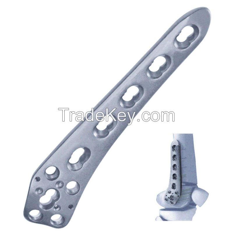 Distal Lateral Femoral Osteotomy Locking Bone Plate