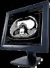 DICOM/Video CT/DR/CR/MR/XRay/DSA/US/Etc. Медицинское програмное обеспечение рабочего места