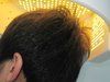 2013 продукта роста волос терапией лазера новых диода низкоуровневых с экраном LCD