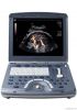 GE Ultrasound machine Voluson e