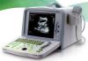 Ultrasound Scanner KX2000