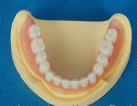 Зубоврачебные съемные акриловые зубы Denture