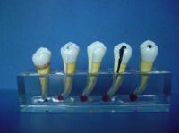 Модель B Endodontics популярная воспитательная