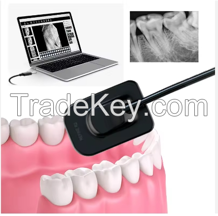 Dental X ray Sensor Dental Sensor Oral X Ray Imaging System Intra Dental Digital rvg Sensor