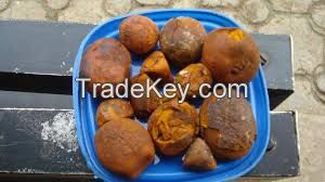 Cow and OX Gallstone in Dubai