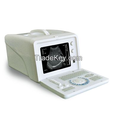 Digital Portable Ultrasound Scanner +STT-2018CI