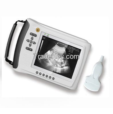 Veterinary Handheld Ultrasound Scanner+STT-3018V