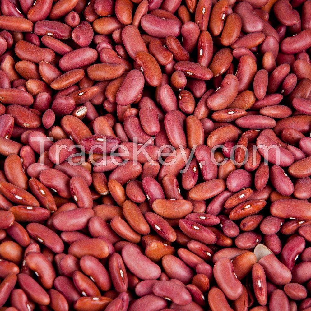 Wholesale Light Speckled Kidney Beans