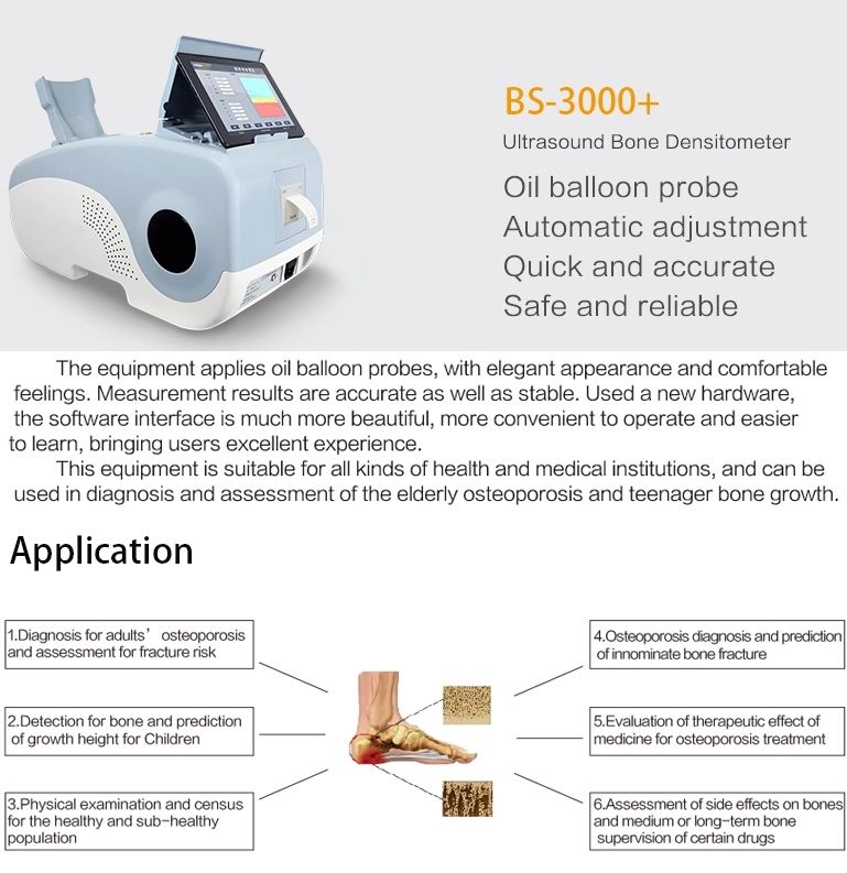 Add to CompareShare High Effective Ultrasonic density detector Ultrasound bone densitometer BS-3000+ with low price