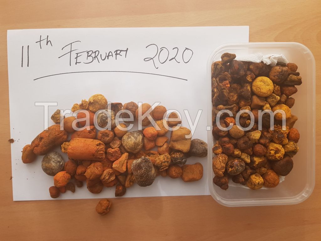 OX/COW Gallstones