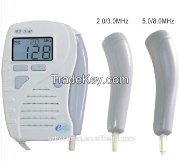 fetal Doppler