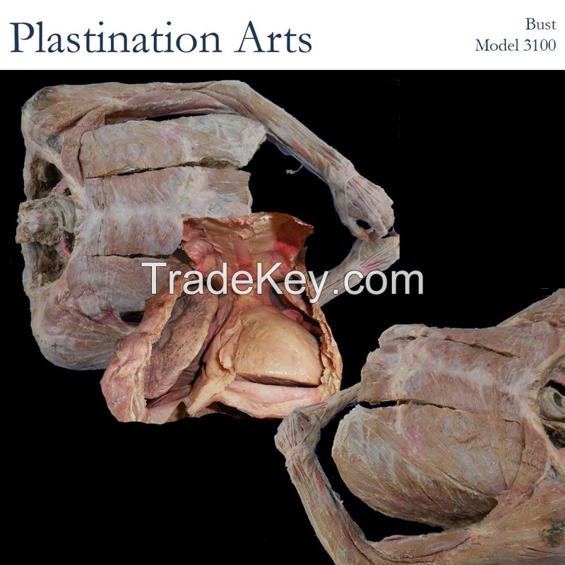 Plastinated Upper Extremity