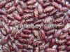 Purple Speckled Kidney Beans