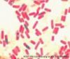 Sell Bacillus Subtilis & Bacillus Licheniformis