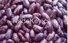 Purple speckled kidney bean and Other Kidney Bean Species.