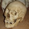 Medical Human Skull Skeleton Shrunken Head Brain Specimen