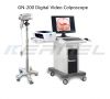 Digital Video Colposcope GN200 Colposcopy System for Obstetrics Gynecology Cervical Cancer Vagina