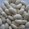 White Kidney Beans, kidney beans, bean, many kind.