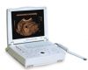 sell Ultrasound scanner