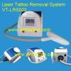tattoo laser machine, removable machines, tattoo machines