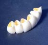Sell CEPTE gold deposition porcelain teeth