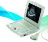 Sell Digital Laptop Ultrasound Scanner (KX5000)