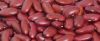 Kidney Beans, Red Kidney Beans, White Kidney Beans, Sparkle Kidney