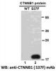 Anti-CTNNB1 (S37F) Mouse Monoclonal Antibody