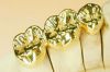 Sell Guoyou Gold Dental Crown