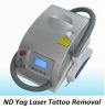 Sell ND Yag Laser Tatoo Removal