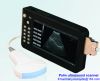 Sell Palm Type Ultrasound Scanner