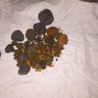 ox gallstones/cattle gallstones/cow gallstone