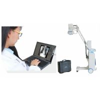 Digital Mobile X-ray System