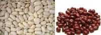 Certified White Kidney Beans/Cranberry Bush Dry Bean (Best Price and Quality)