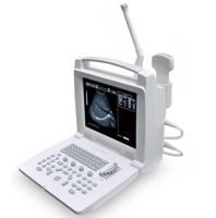 Full Digital Portable Ultrasound Scanner +STT-3018I
