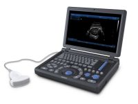 Canyearn A15 Full Digital Laptop Ultrasonic Diagnostic System Black and White Ultrasound Scanner