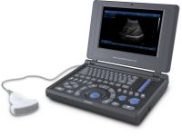 Canyearn A10 Full Digital Laptop Ultrasonic Diagnostic System Black and White Ultrasound Scanner