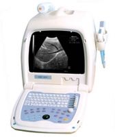 Sell Portable Ultrasound Scanner(OSEN800T)