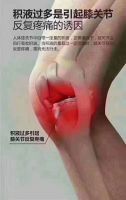 chinese therapy essential oil ease the pain for the knee