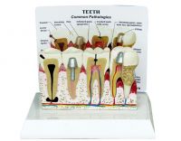 Sell Teeth model w/description plate
