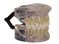 completely transparent primary dentition model