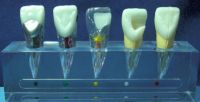 Endodontics popular educational model A