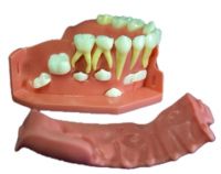 dentural development model B