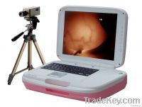 Sell Infrared Diagnostic Instrument for Mammary Gland