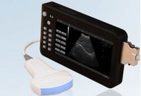 Palm Size Ultrasound Scanner