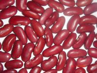 DARK RED KIDNEYBEANS , MILLETS